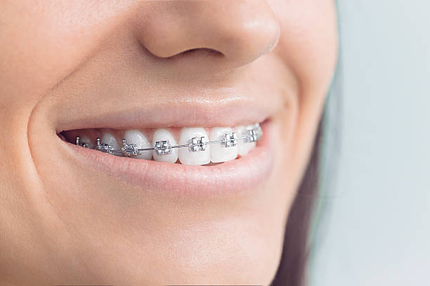 Best Traditional Braces  in Ramtown, NJ